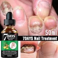 Tratamiento de hongos en las uñas, suero de esencia para el cuidado de las manos y los pies, Gel de reparación, antiinfeccioso, paroniquia, onicomicosis Tan Jianjun unisex | Walmart en línea