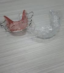Maybe you would like to learn more about one of these? Tips Penjagaan Retainer Klinik Pergigian Ancasa Facebook