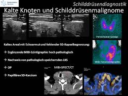 Für die normale szintigrafie der schilddrüse wird wegen der geringeren strahlenbelastung in der regel kein radioaktiv markiertes jod, sondern radioaktives technetium verwendet. Spezielle Schilddrusendiagnostik Bei Kalten Knoten Nuklearmedizin Neumann