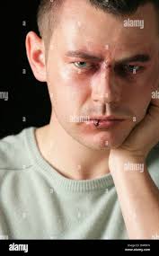 Beat up eye hi-res stock photography and images