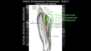 Image result for Obturator Nerve Compression