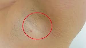 We did not find results for: How To Get Rid Of Underarm Razor Bumps Youtube