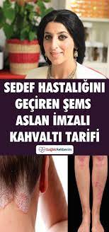 Sedef Hastaligini Geciren Sems Aslan Imzali Kahvalti Tarifi Dogal Saglik Kahvalti Tarifleri Saglik