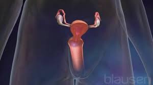 Sind die scheide, der darm oder die harnblase von endometriose befallen, ist die komplette operative entfernung der herde die derzeit effektivste therapie. Eierstockzyste Symptome Ursachen Behandlung Onmeda De
