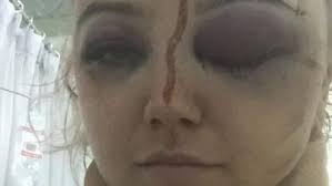 Renae Henry, Reporter Perth News Team