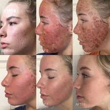 Tricia Parrish Powers