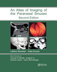 Atlas Of Imaging Of The Paranasal Sinuses Second Edition 2nd Editio