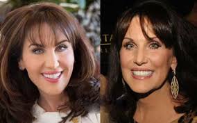 Phil, is an american television personality, author and the host of the television show dr. Dr Phil S Wife Robin Mcgraw Plastic Surgery Did She Really Go Under The Knife Glamour Fame