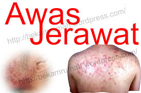 Aku buntu dan malu dengan teman2 n bf ku. Jerawat Badan Dan Wajah Bekam Ke Rumah