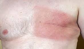 In fact, most people don't even know what it does. 10 Best Clinics For Male Breast Cancer Treatment In Turkey 2021 Prices