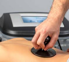 Die elektrotherapie (transkutane elektrische nervenstimulation) zählt zu den physikalischen therapien, die als naturheilkundliches verfahren wissenschaftlich anerkannt sind. Elektrotherapie Physioran