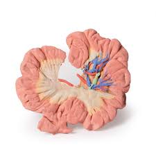 The terminal ileum is the distal end of the small intestine that intersects with the large intestine. 3d Bowel Model Portion Of Ileum Erler Zimmer Mp1725