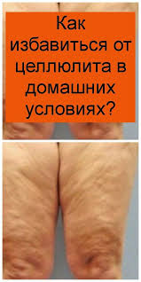 как избавиться от целлюлита в домашних условиях на ногах Kak Izbavitsya Ot Cellyulita V Domashnih Usloviyah V 2020 G Prazdnichnaya Eda Prazdnichnaya Vypechka Uprazhneniya Dlya Nog