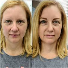 Meet Seung Szczechowski