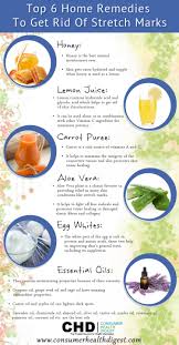 Home Remedies To Get Rid Of Stretch Marks Remedies Stretch Marks Stretch Mark Remedies