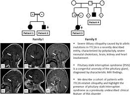 Pituitary Stalk Interruption Syndrome Broadens The Clinical Spectrum Of The Ttc26 Ciliopathy David 2020 Clinical Genetics Wiley Online Library