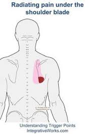 Pin On Back Pain Exercise