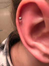 Cartilage Piercing Weird Almost Pimple Like Bump Appears To Be Filled With Pus Should I Attempt To Pop It Or Leave It Alone Piercingadvice