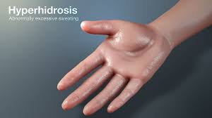 Image result for Hyperhidrosis Causes