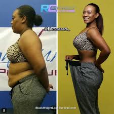 Pin On Before And After Weight Loss Stories