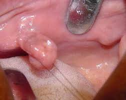 Biópsia Oral cirurgia especialidades odontológicas