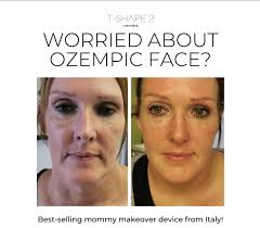 T Shape 2 is the perfect combination of low-level laser therapy, bipolar RF  energy, endodermic massage with suction, and mesosphere massage helps  “mobilize” excess fat cells, which are eliminated by the body's