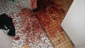 Maintaining a healthy weight and doing regular exercise can prevent blood clots. Blood At Crime Scene Abc News Australian Broadcasting Corporation