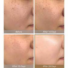 Has been added to your cart. Some By Mi Galactomyces Pure Vitamin C Glow Toner Little Wonderland