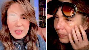 Yolanda Andrade sufre recaída de salud y reaparece con el parche en el ojo  | Univision Famosos | Univision