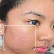 Pin On Free Of Chemicals Organic All Natural Skin Care Products