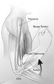 The two most common types of tendinitis rest the your forearm. Biceps Tendon Tear At The Elbow Orthoinfo Aaos