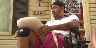 Dre says he's 'doing great' after being hospitalized in icu for apparent brain aneurysm. Motorcyclist Loses Leg After Hit And Run Police Still Looking For Suspect