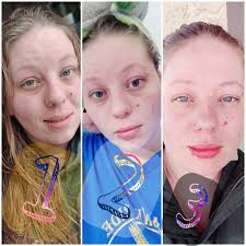 Ever taken a high 3* shadow and purified for a perfect??