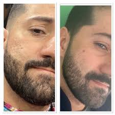 Fisiolev (@fisiolev) · Campina Verde, MG