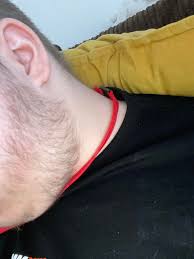 Sure, you could choose to see a skin. I Am Currently 16 Years Old And Have Some Facial Hair On My Face And Under My Neck Most Of My Family Would Call It Bum Fluff Although I Have Above Average