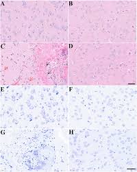 Image result for Alangium chinense