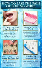 The Smile Expert Dental Clinic Braces Tips Dental Braces Getting Braces