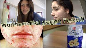 Mein Wundermittel Gegen Pickel Youtube