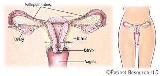 Some signs of cervical cancer are: Patient Resource Publishing Cervical Cancer Overview