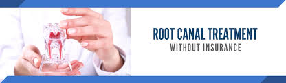 Feb 05, 2019 · the actual root canal therapy usually ranges between $800 and $1,200. Endodontist Near Me No Insurance Ok Root Canal Specialist