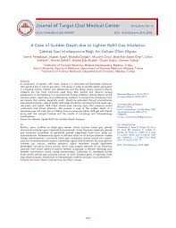 PDF) A Case of Sudden Death due to Lighter Refill Gas Inhalation  Cakmak  Gazi Inhalasyonuna Bagli Ani Gelisen Olum Olgusu