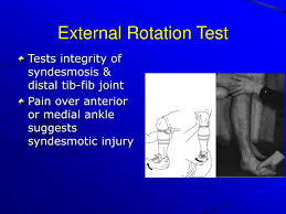 Image result for Ankle External Rotation Test