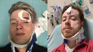 Austin clubs increase reward to $11K for more information in hate crime  investigation