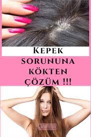 kepek sorununa kokten cozum saglikli sac dogal sac bakimi dogal guzellik ipuclari