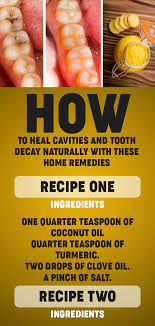 Oral diseases affect 3.58 billion people worldwide, with dental caries being the most prevalent condition.cavities. How To Heal Cavities And Tooth Decay Naturally With These Home Remedies Heal Cavities Tooth Decay Herbal Cure
