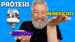 Mi CIRUGÍA de RODILLA