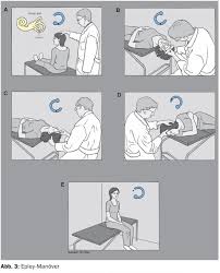Image result for Canalith Repositioning Procedure