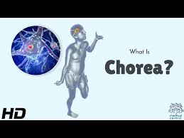 Image result for Chorea