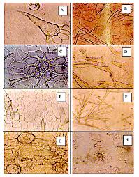 Image result for Crabbea cirsioides
