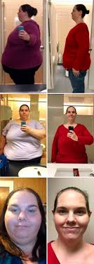 40 Great Examples Of Before And After Weight Losses Best Keto Diet Keto Diet List Diet Doctor Low Carb